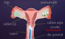 Pap Smear Testi ve Tedavisi