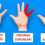 Elleriniz Vücut Sağlığınızla İlgili 7 Önemli Sinyal Veriyor