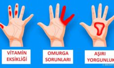 Elleriniz Vücut Sağlığınızla İlgili 7 Önemli Sinyal Veriyor