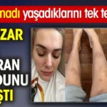 Bergüzar Korel moraran vücudunu paylaştı! Dayanamadı yaşadıklarını anlattı