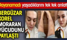 Bergüzar Korel moraran vücudunu paylaştı! Dayanamadı yaşadıklarını anlattı