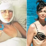 Bedava estetik kabusu