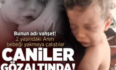 Caniler gözaltında! Devlet korumasına alınan 2 yaşındaki Aren bebek ameliyat edilecek